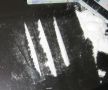 cocaine addiction